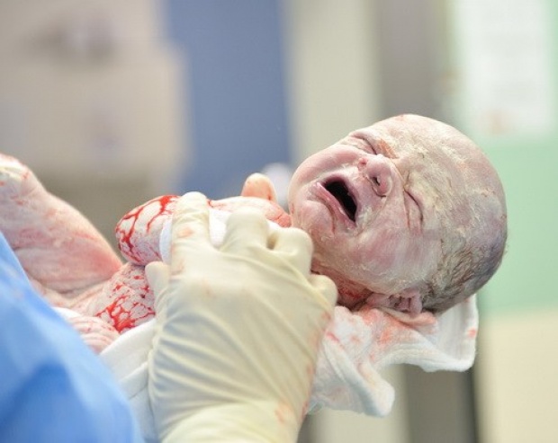 ไขข้อข้องใจ “ไขทารกแรกเกิด” มีดีหรือไม่