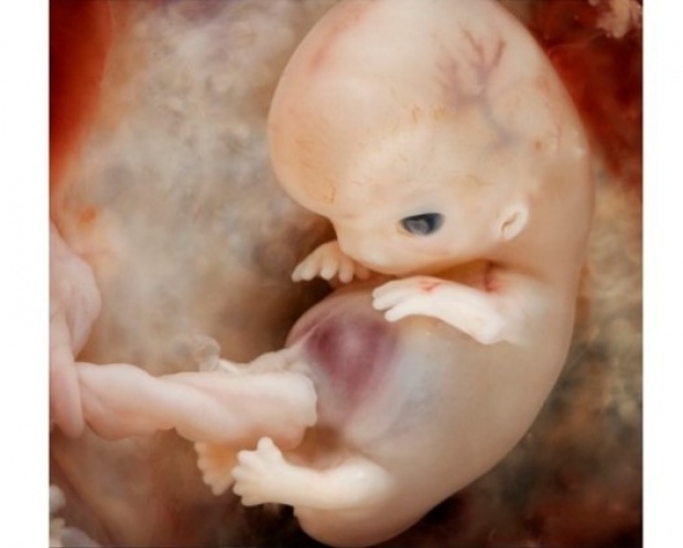 10 ภาพจริงของทารกขณะยังเป็นตัวอ่อนอยู่ในท้องแม่
