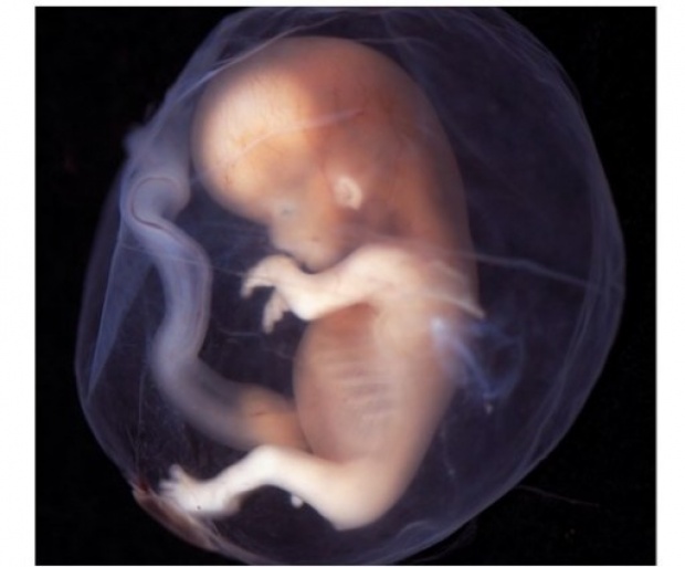 10 ภาพจริงของทารกขณะยังเป็นตัวอ่อนอยู่ในท้องแม่