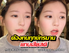 จ้าวลู่ซือ เปิดใจมรสุมป่วยผิวหนังลอกเกือบเสียสติ