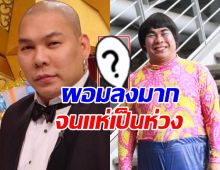 ชาวเน็ตตกใจ! ห่วง โหน่ง ชะชะช่า ทำไมผอมลงขนาดนี้