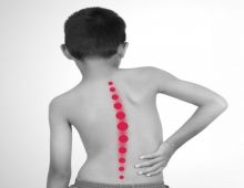 โรคกระดูกสันหลังคดในเด็ก รู้เร็ว ยิ่งรักษาได้ง่าย