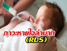 ภาวะหายใจลำบาก (RDS) ภัยร้าย...ทารกแรกเกิด